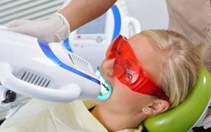 Отбеливание зубов Beyond - Стоматология Линия Улыбки