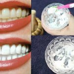 отбеливание зубов в домашних условиях