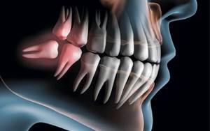 Отек десны если женщина не обращается вовремя к стоматологу - Стоматология «Линия Улыбки»