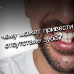 отсутствие зуба