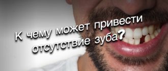 отсутствие зуба