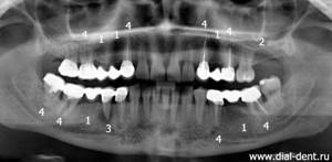 панорамный снимок зубов при обращении