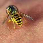 Пчела жалит