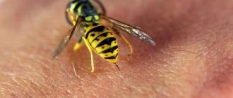 Пчела жалит