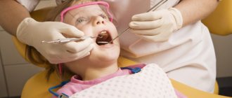 Поговорим о том, как лечат зубы детям