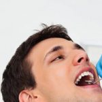 Покрытие зубов гелем