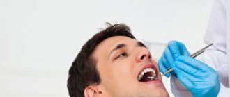 Покрытие зубов гелем