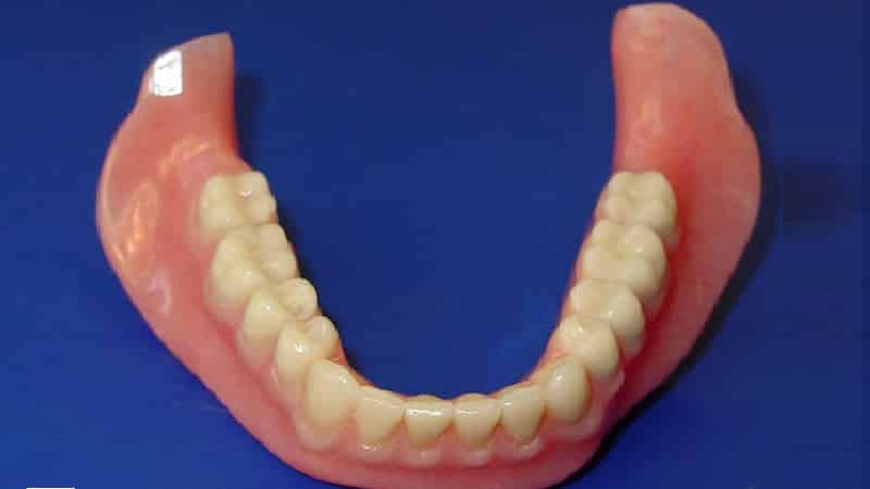 Полиуретановые протезы: достоинства и недостатки, изготовление, отзывы