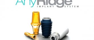 Порядок установки имплантатов Anyridge