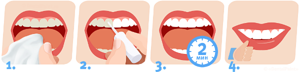 Последовательность нанесения лака для зубов