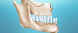 Consequences of ignoring treatment for dental protrusion