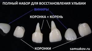 постоянные коронки на зубы