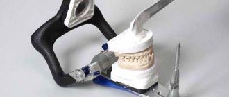 Правила использования гипса в стоматологии