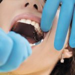 Правила поведения после удаления зуба мудрости - Стоматология «Линия Улыбки»