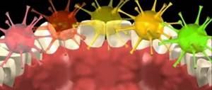 Causes of caries microbes
