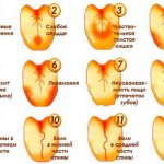 Причины налета