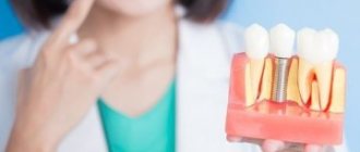 contraindications to dental implantation