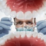 Разновидности протезов и особенности их применения в процессе протезирования передних зубов