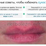 Рекомендации по уходу за губами