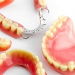 съемные зубные протезы