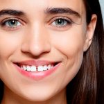 щель между передними зубами фото