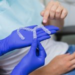 Шинирующий бюгельный протез - Стоматология Линия Улыбки