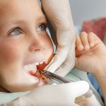 симптомы свища