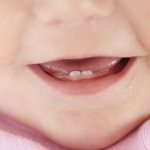 Сколько молочных зубов у детей должно быть