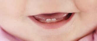 Сколько молочных зубов у детей должно быть