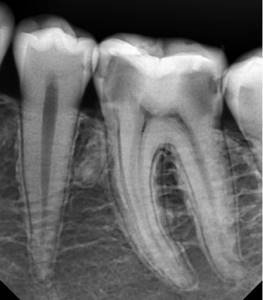 Снимок зубов для диагностики