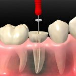 Composition and properties of Forfenan paste in dentistry