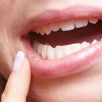 У девушки белый прыщик на десне