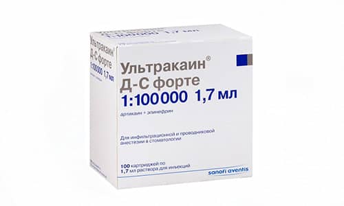 Артикаин или ультракаин, что лучше. Не больно! Современные методы анестезии
