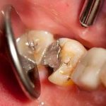 Установка мышьяка