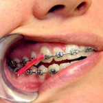 Установка тяг