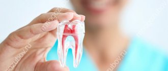 Inflammation of the nerve of the tooth