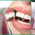 Возможные осложнения после однофазной имплантации зубов