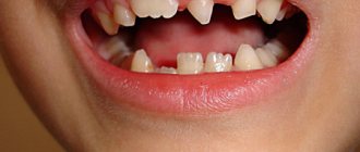All about microdentia and macrodentia