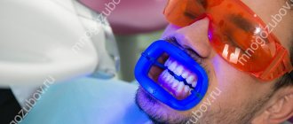 Zoom - teeth whitening