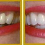 Зубная паста «Рембрандт»: виды, преимущества и особенности