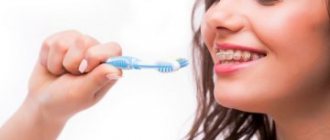 зубная щетка для брекетов: описание, виды, фото