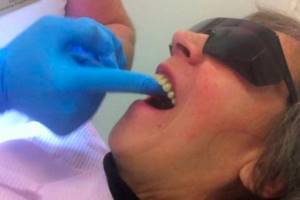 зубные протезы нового поколения